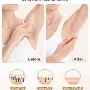 IPL Hair Removal Laser Device 999900 Flashes Auto Manual Dual Mode for Men Women Facial Bikini Hair Laser Home Use