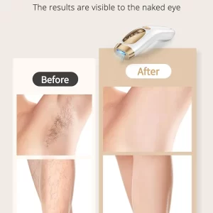 IPL Hair Removal Unlimited Flashes Laser Ice-Cooling Painless Whole Body Treament Safe & Effecctive Home Beauty Device Men Women