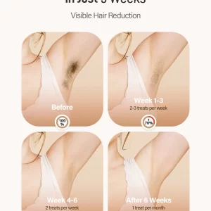 Jooyee Laser Hair Removal AI06 IPL Hair Removal Dual Flashes Mode Effective & Powerful Hair Removal Home Treament for Women Men